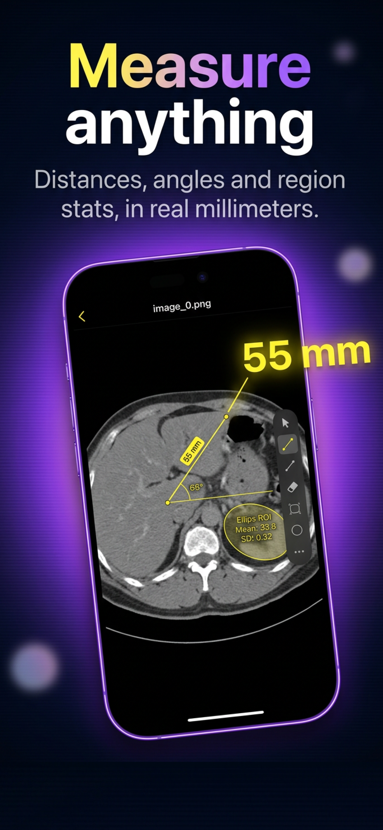 DICOM Viewer: Slicora screenshot 3