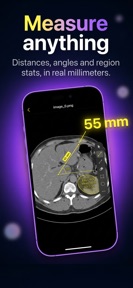 DICOM Viewer: Slicora screenshot