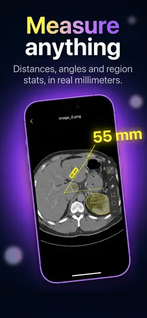 DICOM Viewer: Slicora screenshot 3