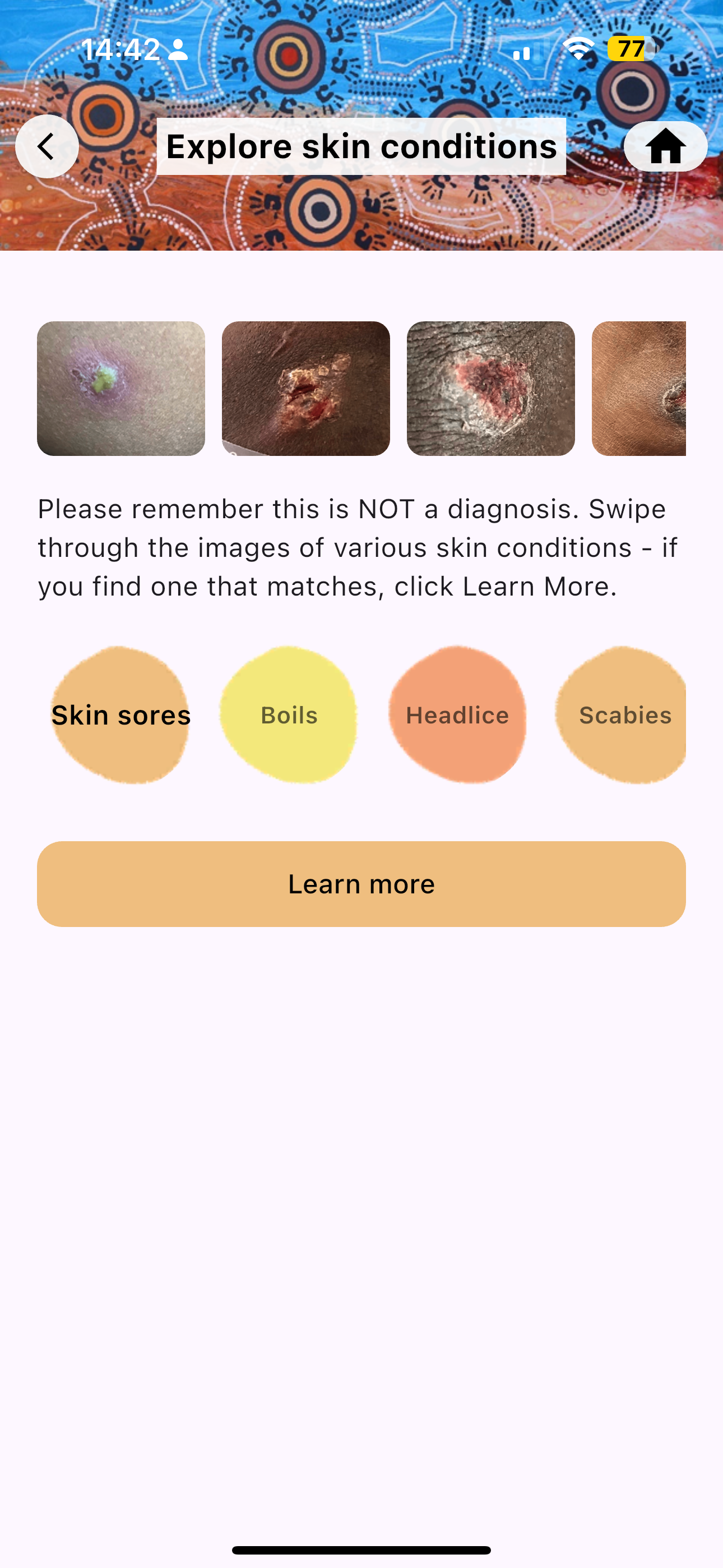 Strong Skin