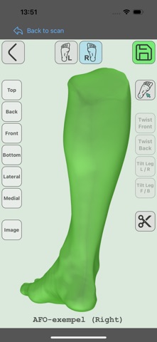 CADMed TrueDepth Scan screenshot