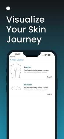AI 皮肤 扫描仪: 护肤 时间 皮疹和  痣 screenshot
