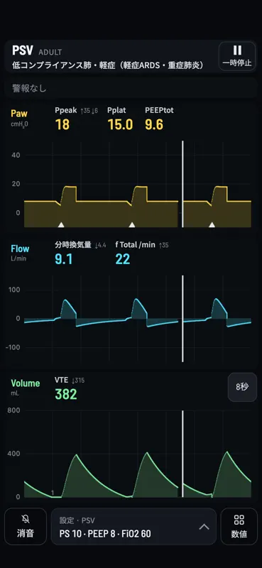 Vent Sim - Ventilator Training screenshot 4 of 6
