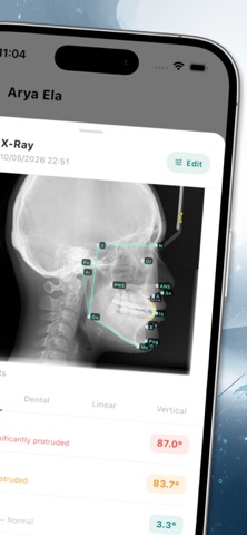 Ortholine - for Orthodontists Screenshot 3 of 6