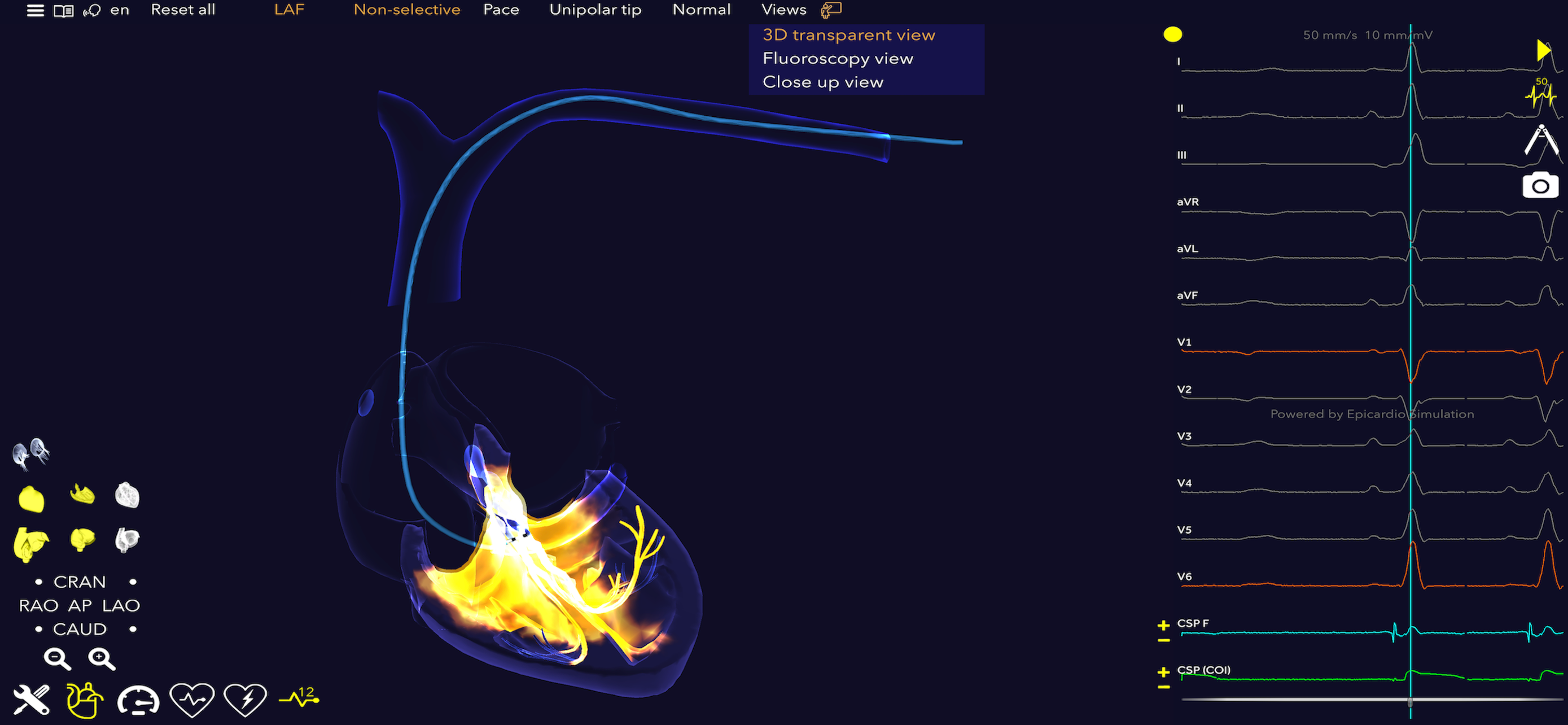 Medtronic VirtualPulse screenshot 7