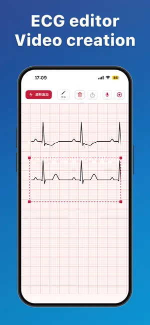 ECGStudio: ECG Draw & Lecture screenshot 1