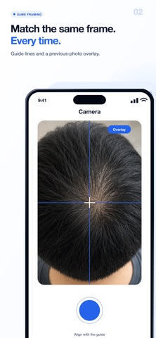 HagePasha: Hairline in Focus iPhone screenshot
