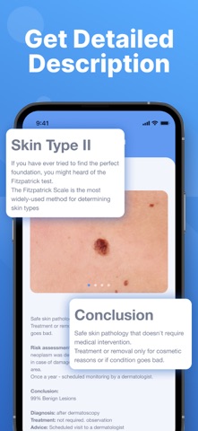 AI Skin Scanner: Mole Tracker screenshot