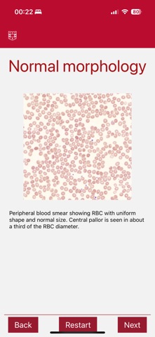 WashU Medicine Easy CBC screenshot