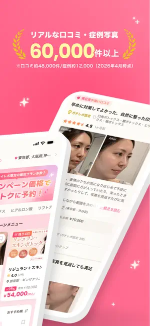 キレイレポ（美容医療の予約アプリ） iPhone screenshot 2