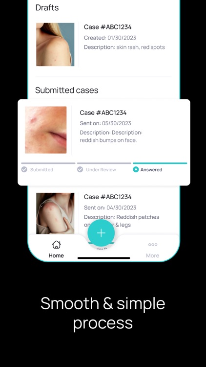 Dermatology First Derm screenshot-6