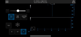 SonicAid Screenshot 4 of 6