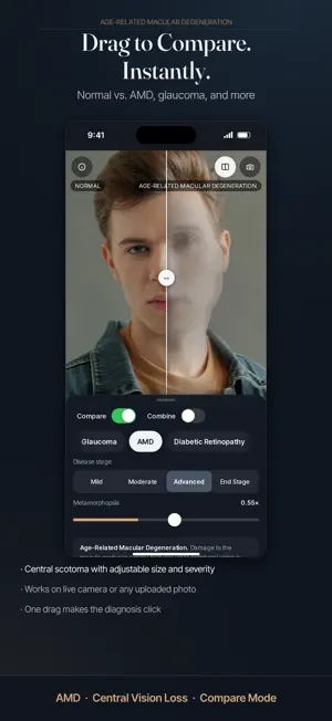 Vision Simulator: Eye Disease screenshot 3