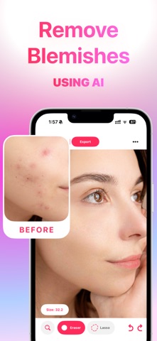 Blemish Remover· screenshot