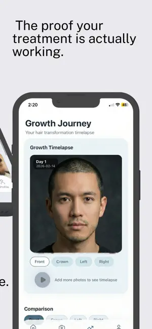 Hair Growth Timelapse screenshot 3
