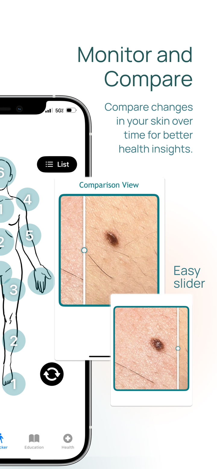 Skin-Check screenshot 7
