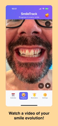 SmileTrack - Retainer tracking Screenshot 3 of 3