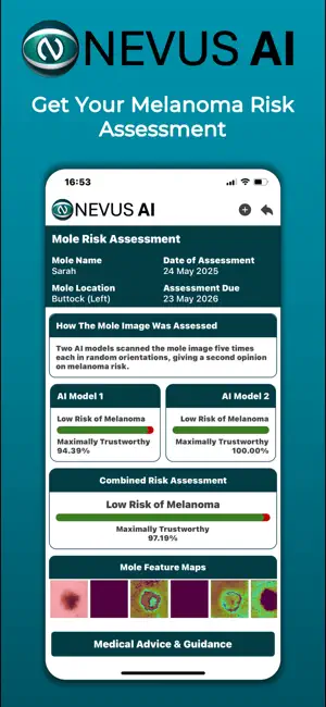 Nevus AI screenshot 1