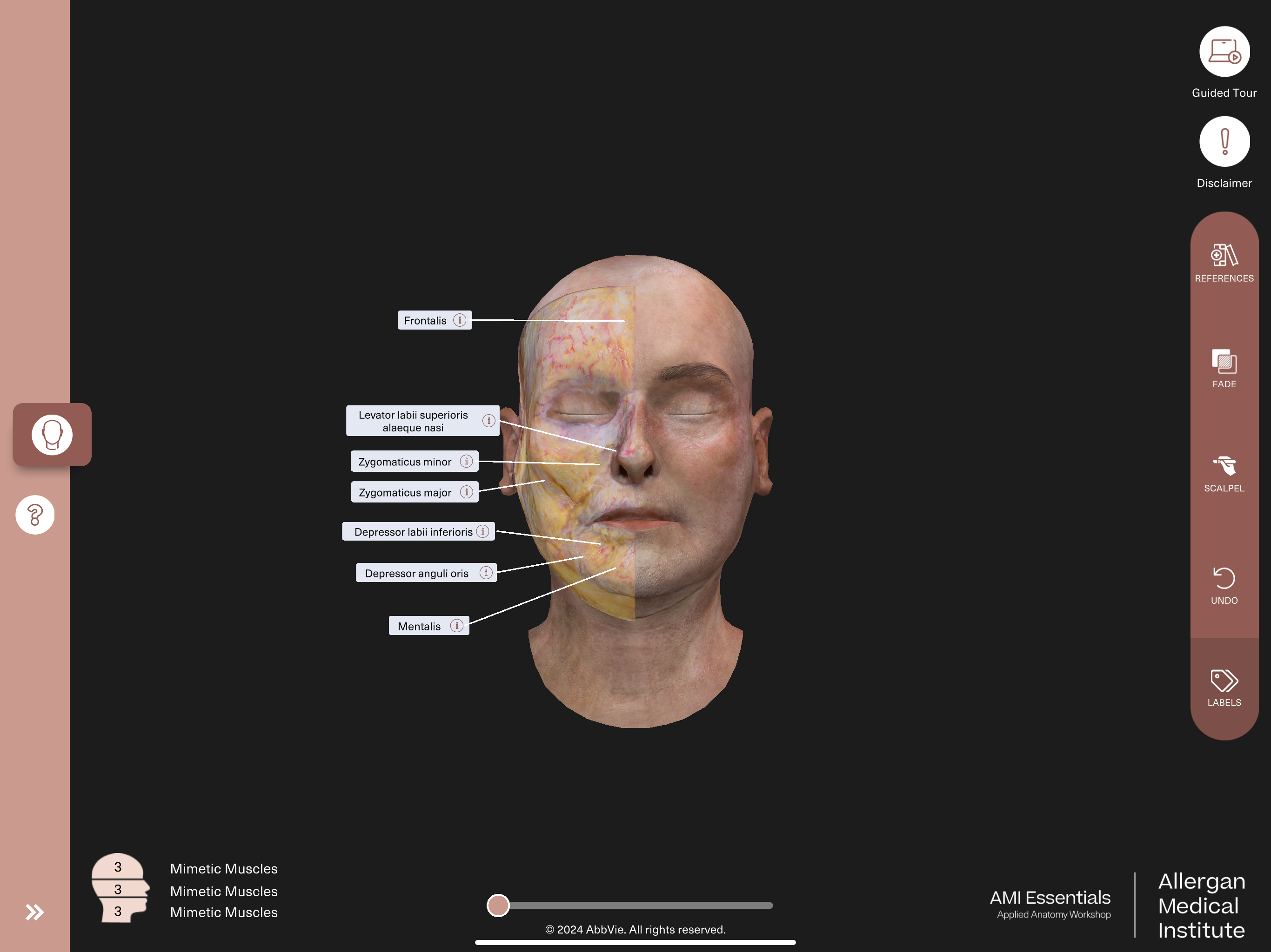 AMI Essentials:3D Anatomy BNL screenshot 16
