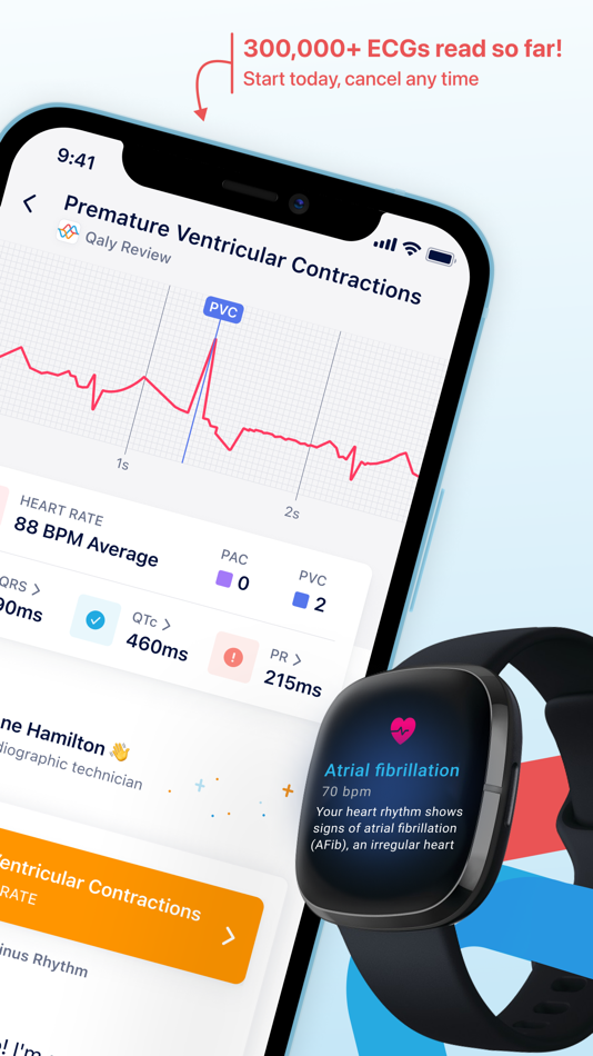 #2. Qaly | ECG Reader (iOS) De: Qaly, Inc.