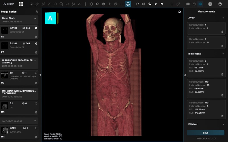Dicom Browser Screenshot