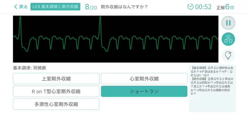 心電図マスターアプリ screenshot 7 of 10