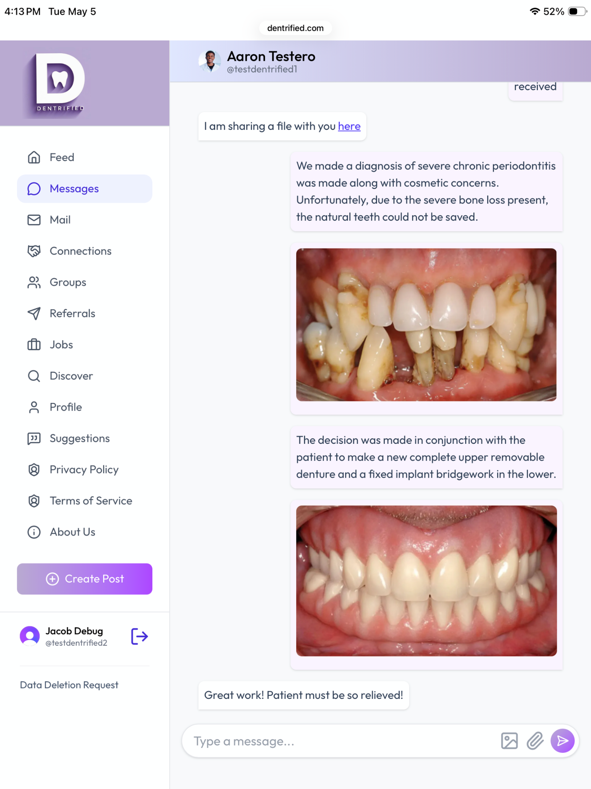 Dentrified