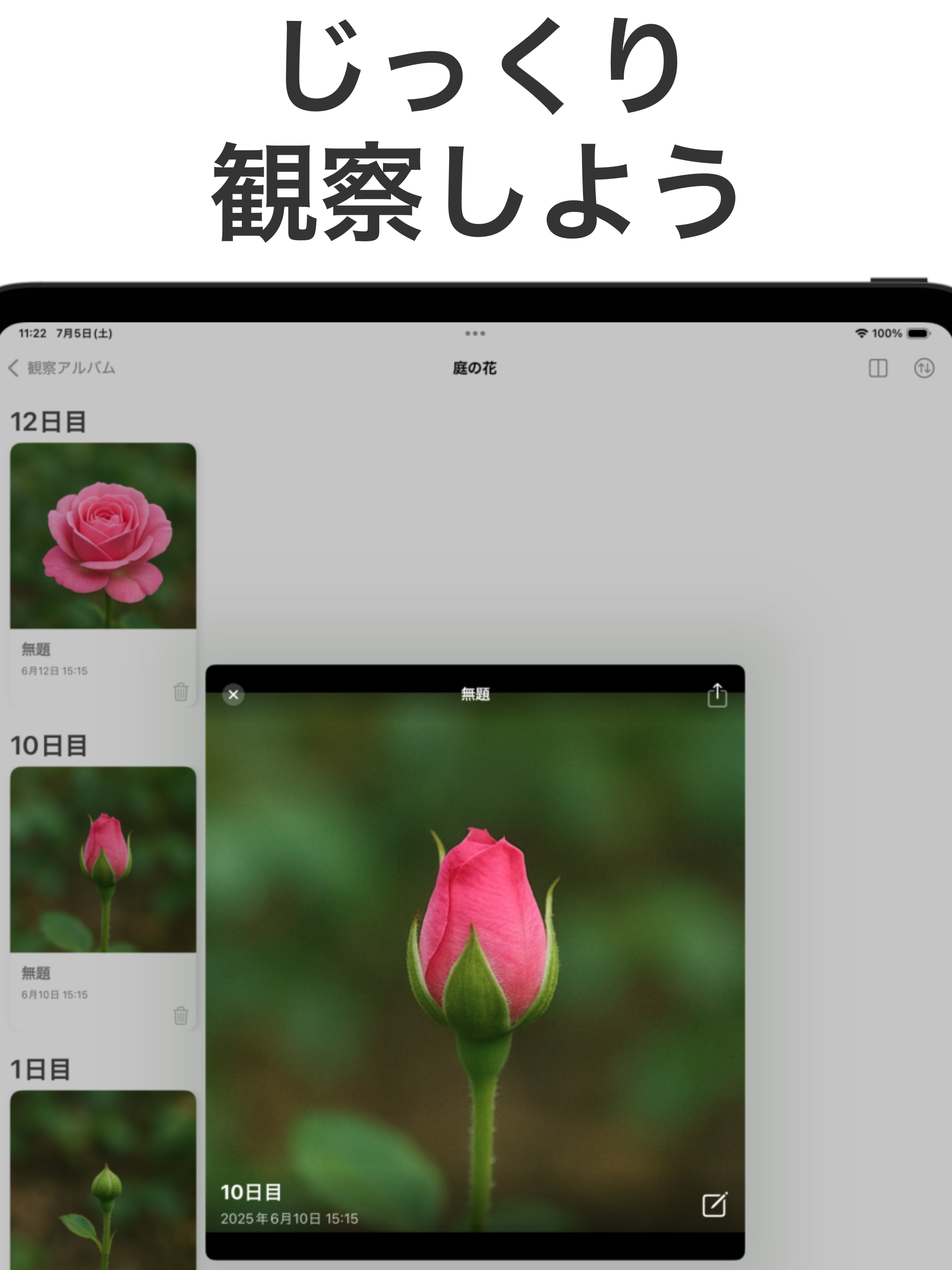 経過観察アルバム - 写真を撮って経過を記録しよう