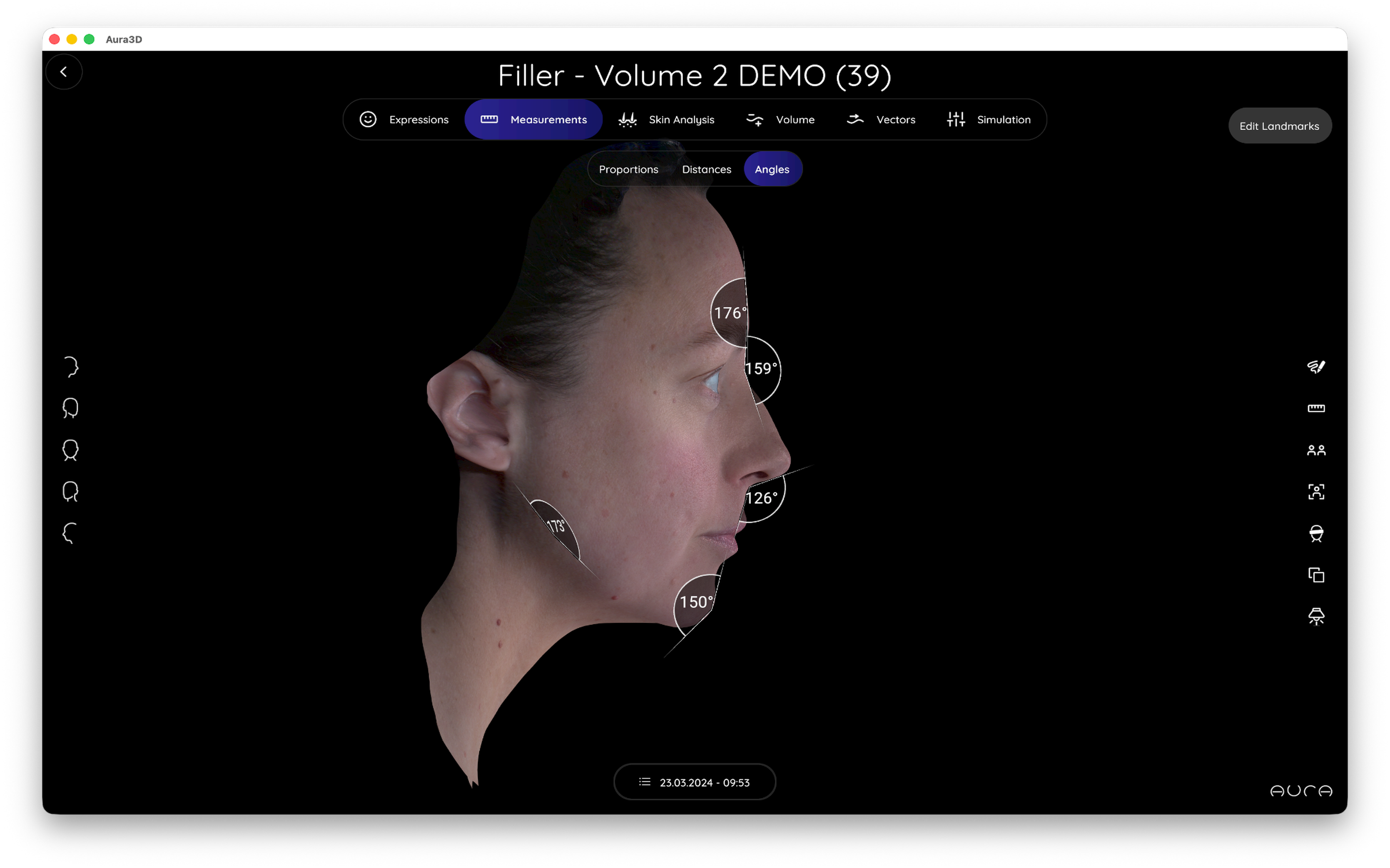 Aura 3D Imaging screenshot 13