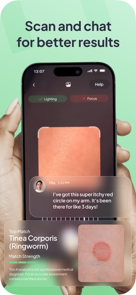 Rash ID: Skin Rash Identifier - Medical App | MWM