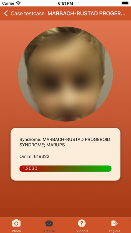 GestaltMatcher screenshot-4