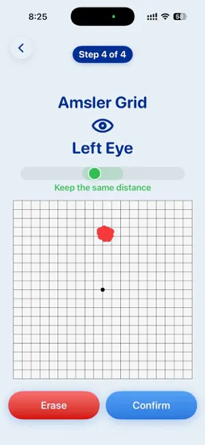 MyRetina screenshot 3