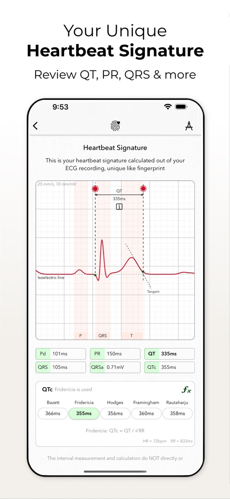 ECG+ | Your Watch ECG Reader - L'application calcule une signature unique du battement cardiaque en analysant précisément les ondes PQRST et propose plusieurs méthodes de calcul pour l'intervalle QTc.