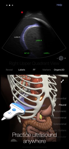 PoCUS Pocket Trainer Screenshot 5 of 5