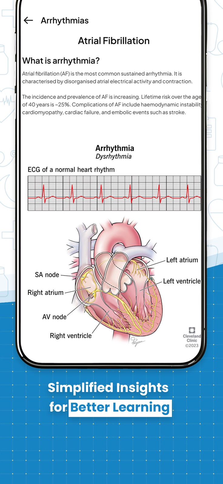 ECG Practice iphone screenshot 2