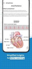 ECG Practice screenshot