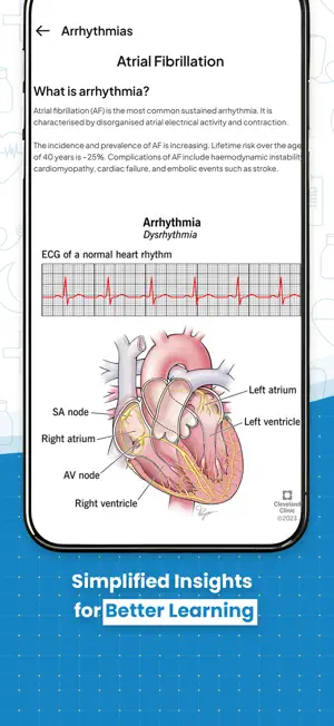ECG Practice screenshot 2