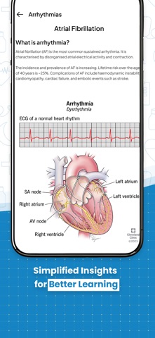 ECG Practice screenshot