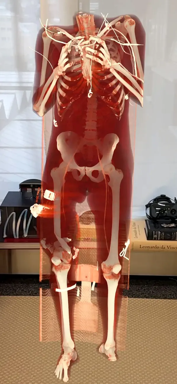 Screenshot #3 pour Medicalholodeck®