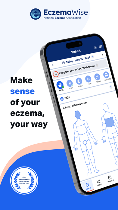 Eczema Skin Care | EczemaWise Screenshot