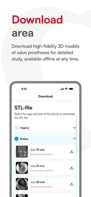 MatchSAVR screenshot 4