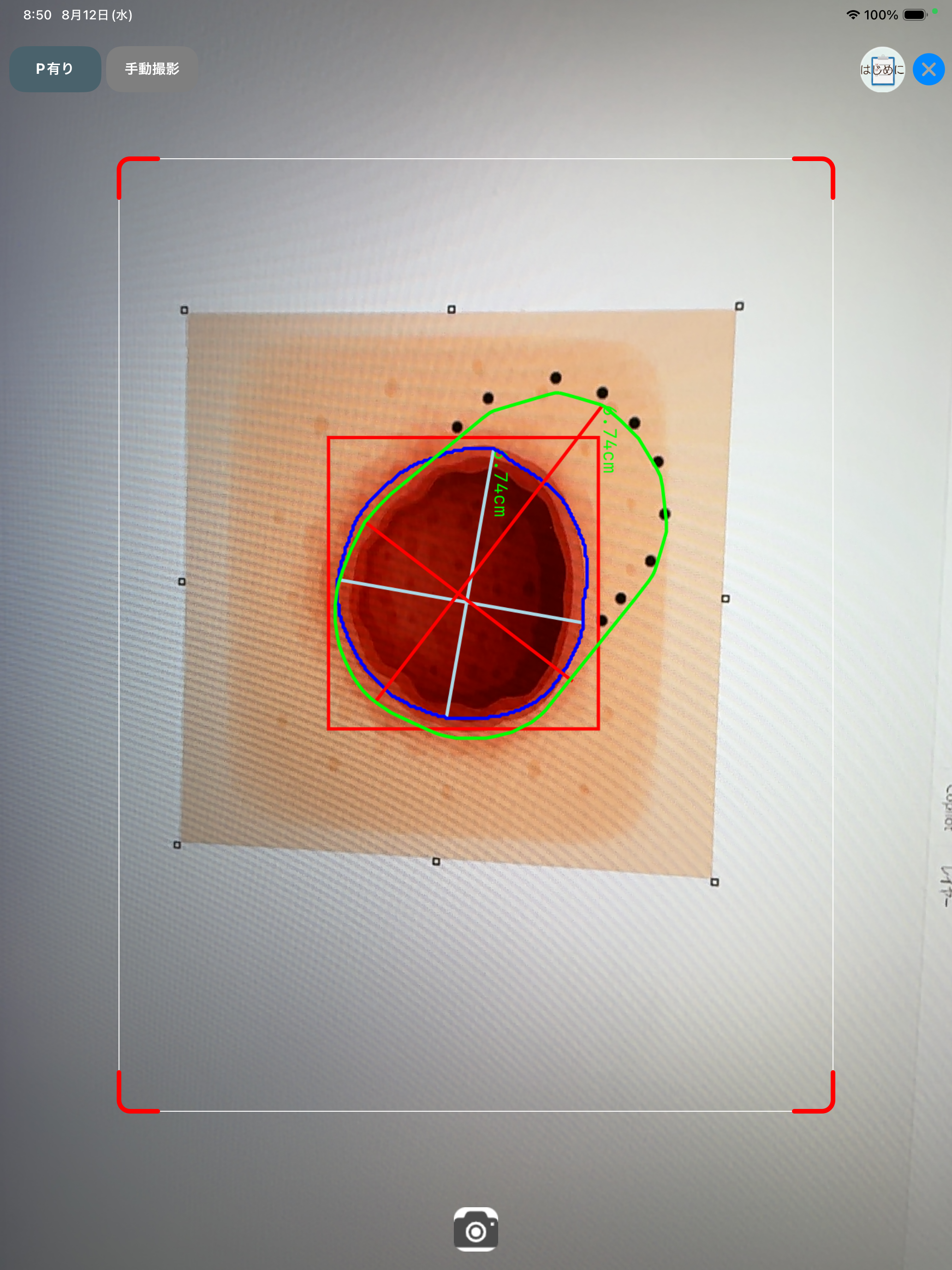 褥瘡Measure screenshot 10