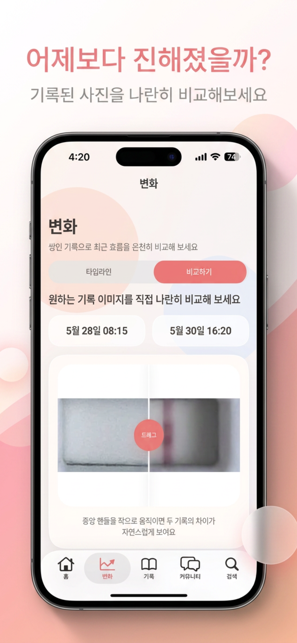 임신 테스트기 판독 기록 - TestNote