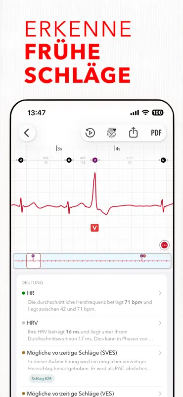 ECG+ | Your Watch ECG Reader screenshot 1 of 10