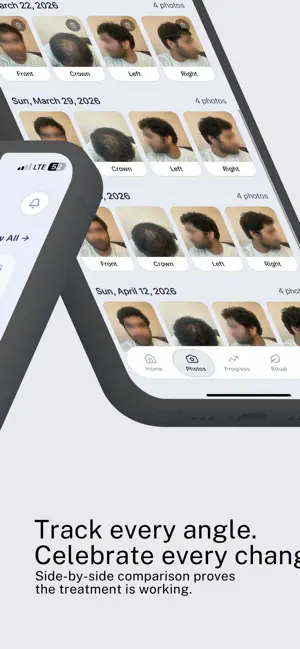 Hair Growth Timelapse screenshot 2