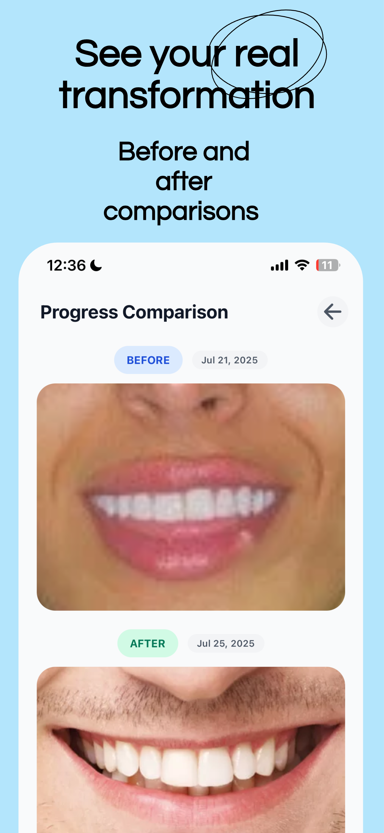 Brightly AI: Smile Better