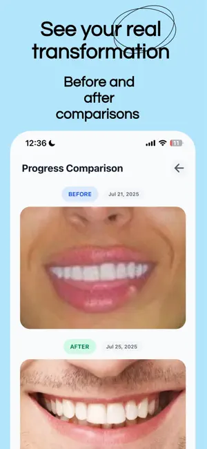 Brightly AI: Smile Better screenshot 4