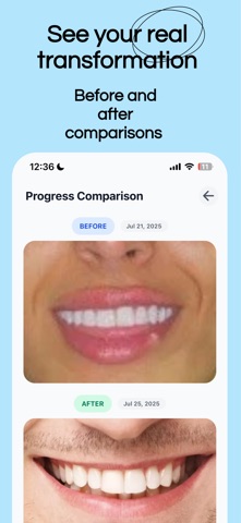Brightly AI: Smile Better screenshot