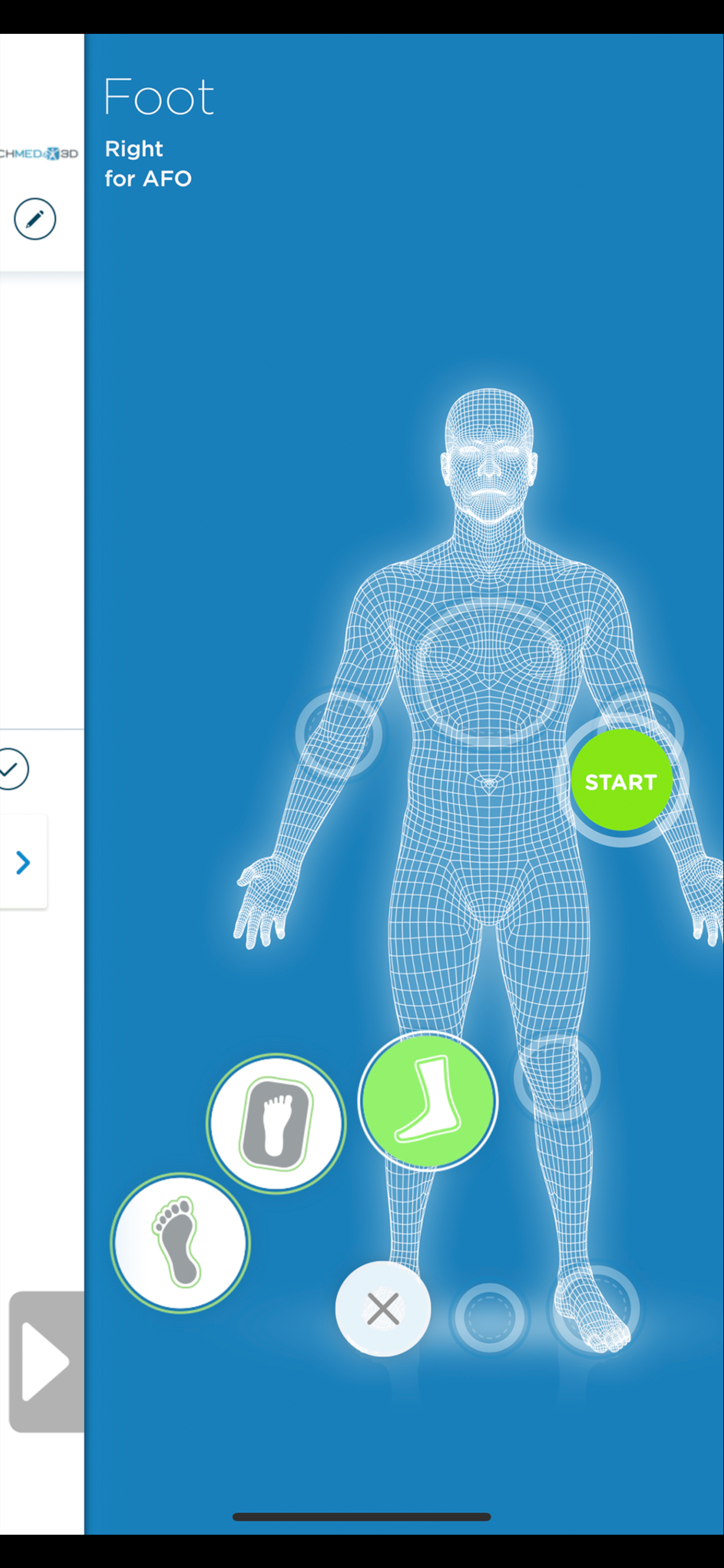 Protosthetics Scan & 3D Print