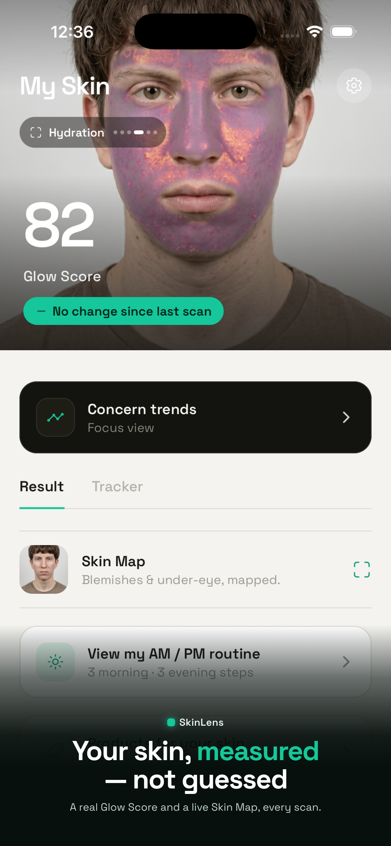 SkinLens: AI Skin Analysis screenshot 3
